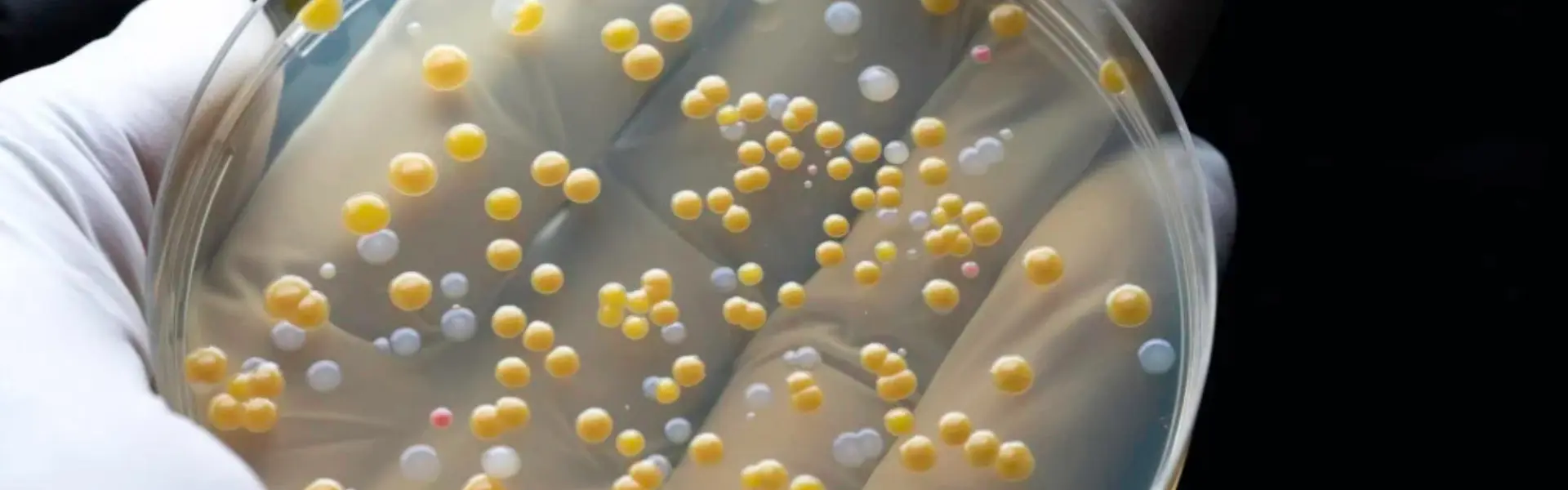 What is the Difference Between Microbiome & Microbiota