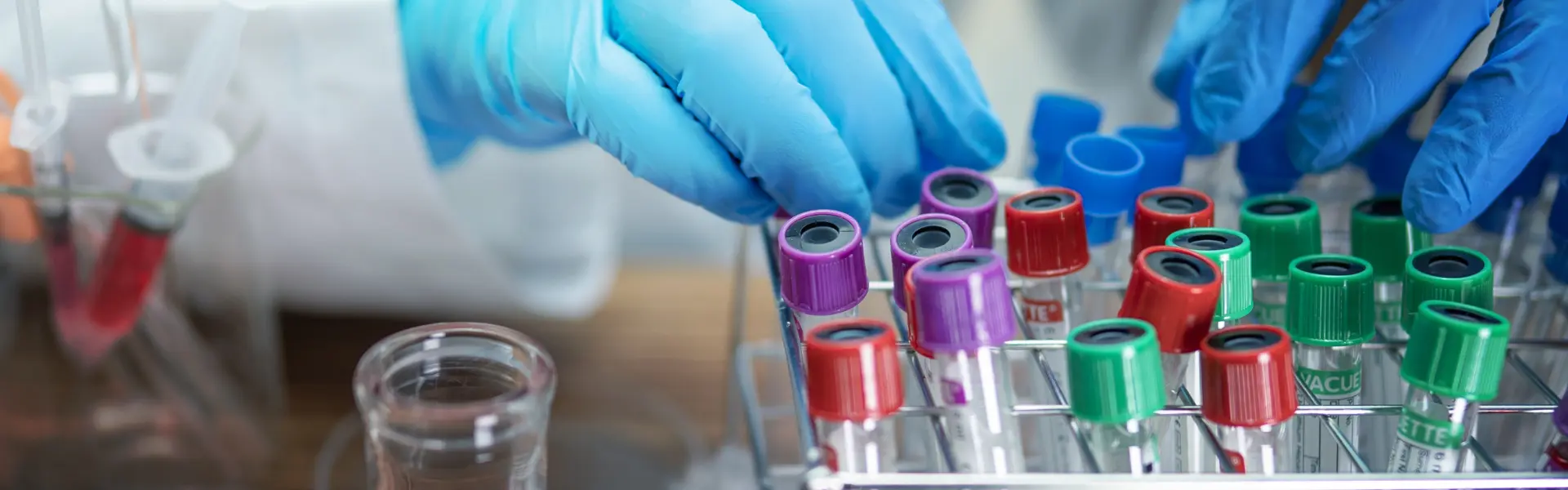Immunotherapy for Cancer: The Evolving Role of CAR T-Cell Therapy