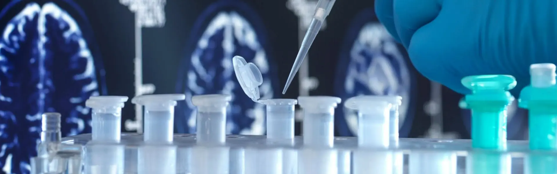Therapeutics for Rare Seizure Disorders