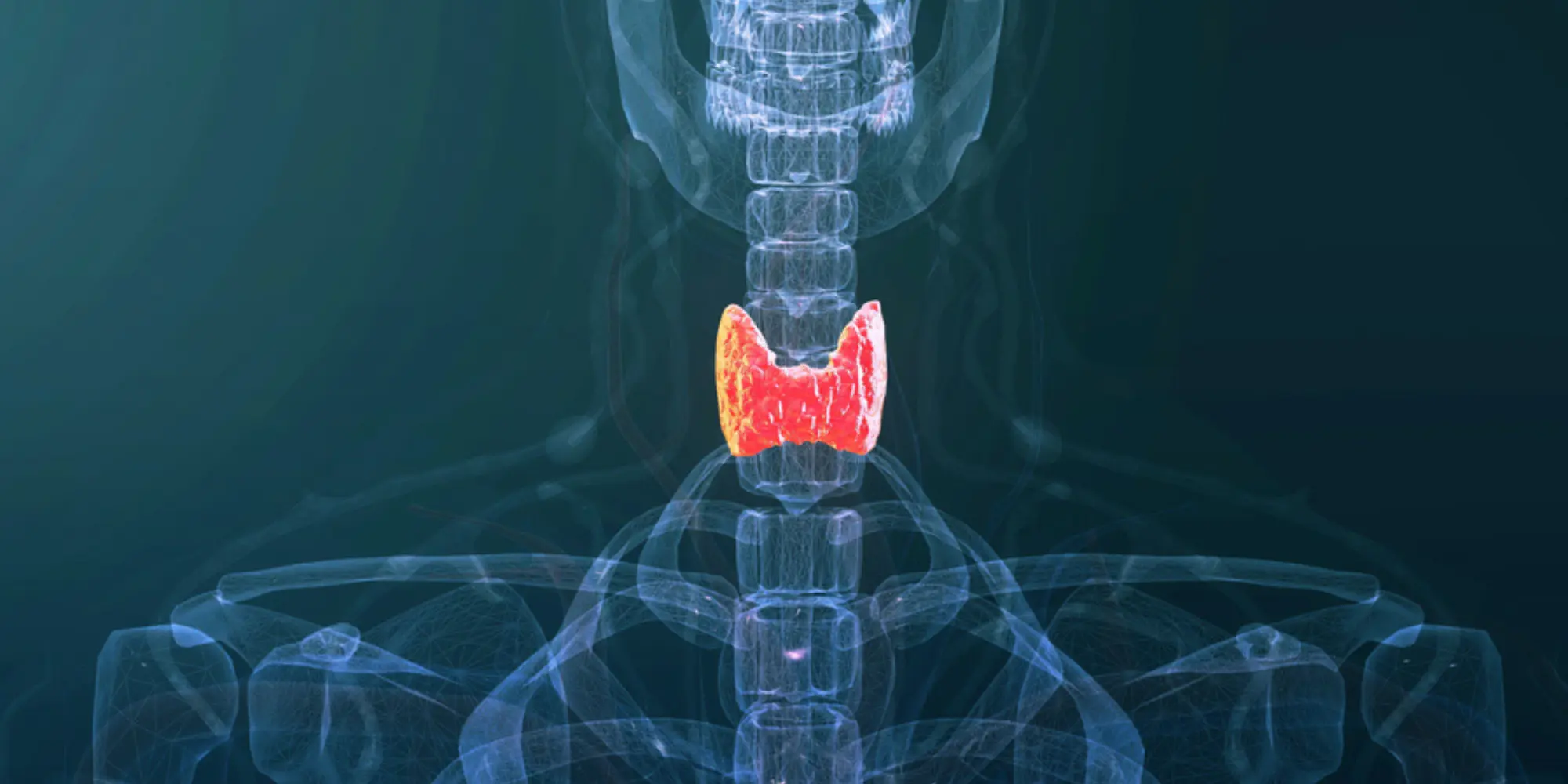 Endocrine Disorders