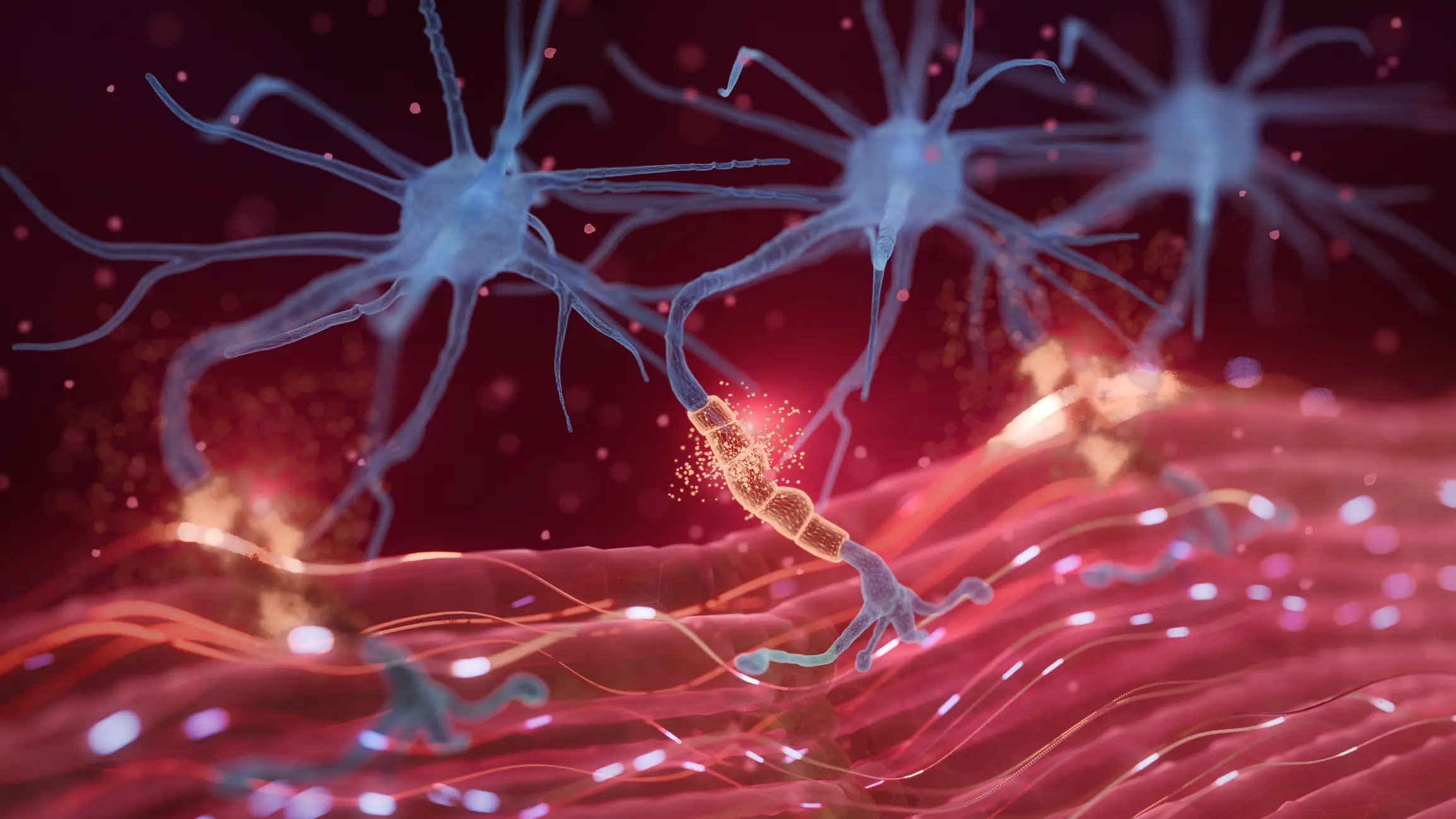 Neuromuscular Disorders